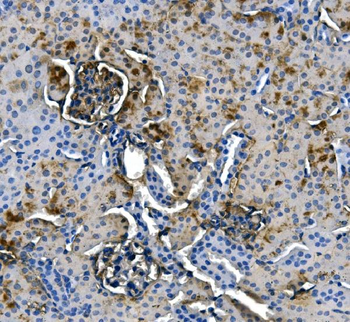 ASS1 Mouse Monoclonal Antibody