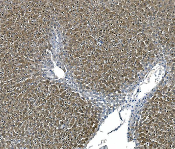 ASS1 Mouse Monoclonal Antibody
