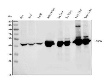 ASS1 Mouse Monoclonal Antibody