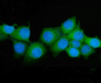 ASS1 Mouse Monoclonal Antibody