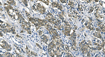 ASS1 Mouse Monoclonal Antibody