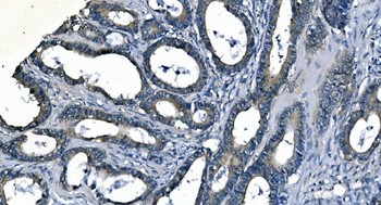 ASS1 Mouse Monoclonal Antibody
