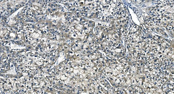ASS1 Mouse Monoclonal Antibody