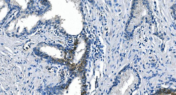 ASS1 Mouse Monoclonal Antibody