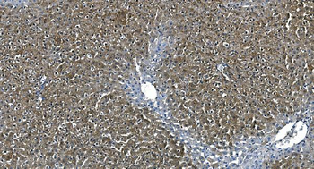 ASS1 Mouse Monoclonal Antibody