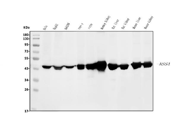 ASS1 Mouse Monoclonal Antibody