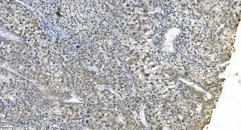 eRF1/ETF1 Mouse Monoclonal Antibody