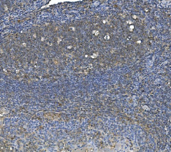 eRF1/ETF1 Mouse Monoclonal Antibody