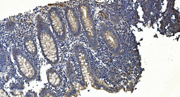 APPL/APPL1 Mouse Monoclonal Antibody