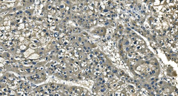 CD13/ANPEP Mouse Monoclonal Antibody
