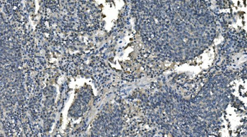 CD13/ANPEP Mouse Monoclonal Antibody