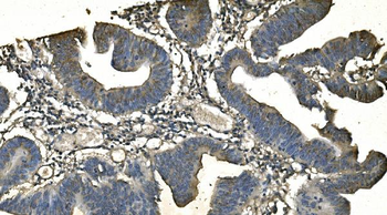 CD13/ANPEP Mouse Monoclonal Antibody