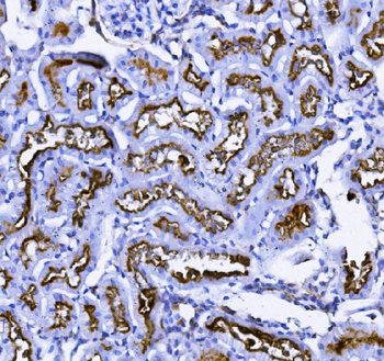 CD13/ANPEP Mouse Monoclonal Antibody