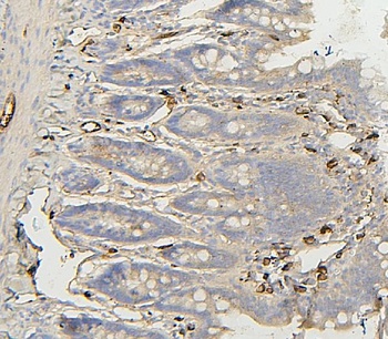 BAK/BAK1 Rabbit Polyclonal Antibody