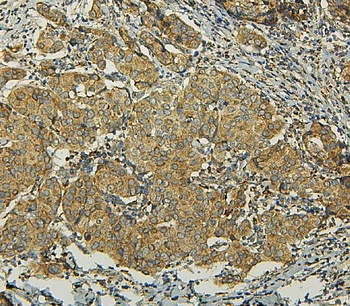 BAK/BAK1 Rabbit Polyclonal Antibody