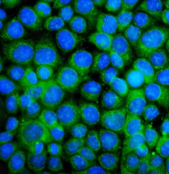 BAK/BAK1 Rabbit Polyclonal Antibody