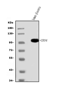 CD34 Rabbit Polyclonal Antibody