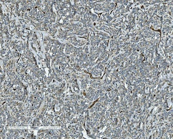 CD34 Rabbit Polyclonal Antibody