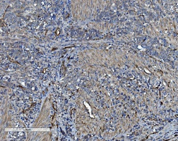 CD34 Rabbit Polyclonal Antibody
