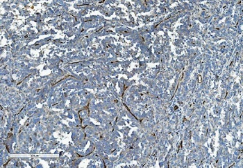 CD34 Rabbit Polyclonal Antibody