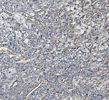CD34 Rabbit Polyclonal Antibody
