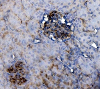 CD34 Rabbit Polyclonal Antibody