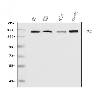 N Cadherin/CDH2 Rabbit Polyclonal Antibody