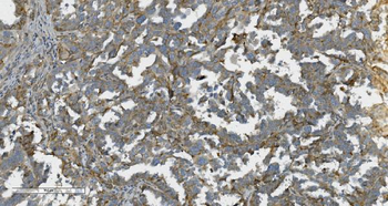 K Cadherin/CDH6 Rabbit Polyclonal Antibody