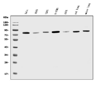 K Cadherin/CDH6 Rabbit Polyclonal Antibody