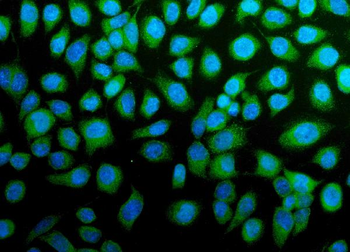H Cadherin/CDH13 Rabbit Polyclonal Antibody