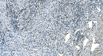 H Cadherin/CDH13 Rabbit Polyclonal Antibody