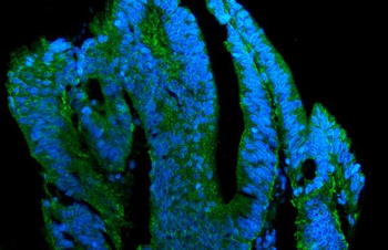 Claudin 7/CLDN-7/CLDN Rabbit Polyclonal Antibody