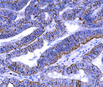 Claudin 7/CLDN-7/CLDN Rabbit Polyclonal Antibody