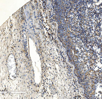 Collagen VII/COL7A1 Rabbit Polyclonal Antibody