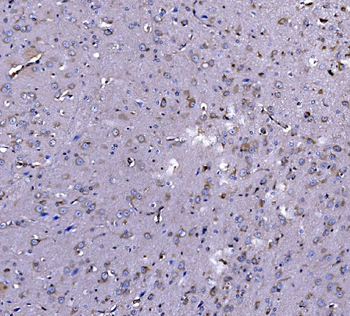 EEF2/Elongation factor 2 Rabbit Polyclonal Antibody