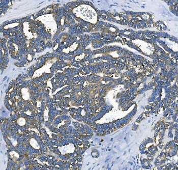 EEF2/Elongation factor 2 Rabbit Polyclonal Antibody