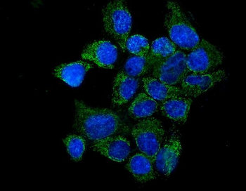IL37 Rabbit Polyclonal Antibody