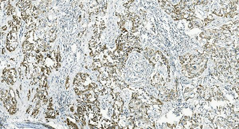 IL37 Rabbit Polyclonal Antibody