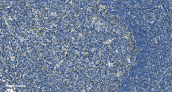 IL37 Rabbit Polyclonal Antibody