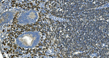 CD20/MS4A1 Rabbit Polyclonal Antibody