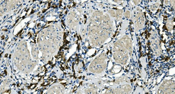 CD20/MS4A1 Rabbit Polyclonal Antibody