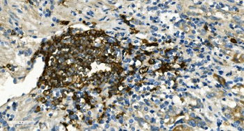 CD20/MS4A1 Rabbit Polyclonal Antibody