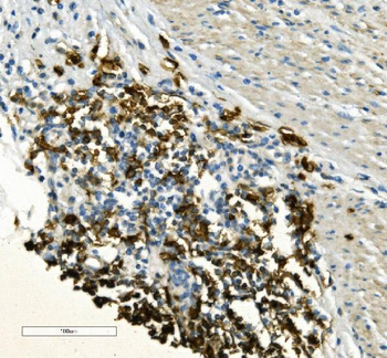 CD20/MS4A1 Rabbit Polyclonal Antibody