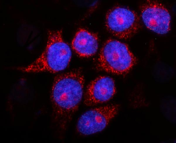 Presenilin 2/AD5/PSEN2 Rabbit Polyclonal Antibody