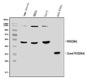 Presenilin 2/AD5/PSEN2 Rabbit Polyclonal Antibody