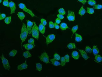ROCK2 Rabbit Polyclonal Antibody