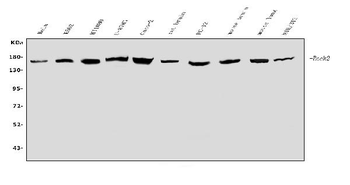 ROCK2 Rabbit Polyclonal Antibody