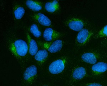 SCG10/STMN2 Rabbit Polyclonal Antibody