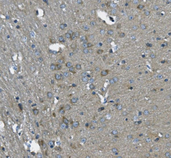 SCG10/STMN2 Rabbit Polyclonal Antibody