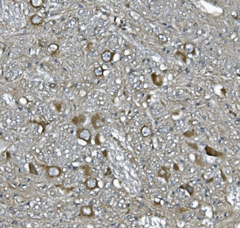 SCG10/STMN2 Rabbit Polyclonal Antibody